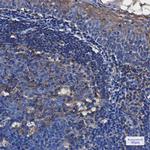 TRK fused gene Recombinant Rabbit Monoclonal Antibody (K01_2J60)