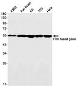 TRK fused gene Antibody in Western Blot (WB)
