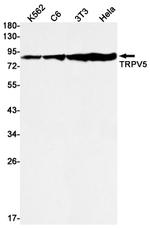 TRPV5 Recombinant Rabbit Monoclonal Antibody (K01_2J61)