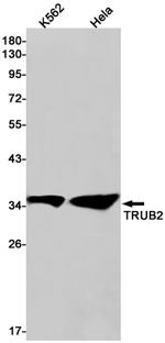 TRUB2 Recombinant Rabbit Monoclonal Antibody (K01_2J62)