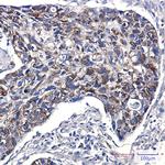 FIS1 Antibody in Immunohistochemistry (Paraffin) (IHC (P))