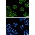 TTF2 Recombinant Rabbit Monoclonal Antibody (K01_2J67)