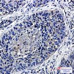 TTF2 Antibody in Immunohistochemistry (Paraffin) (IHC (P))