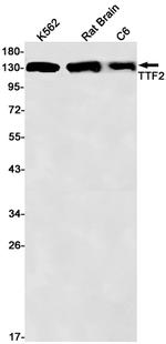 TTF2 Antibody in Western Blot (WB)