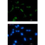 TPPP Recombinant Rabbit Monoclonal Antibody (K01_2J68)