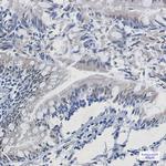 TPPP Antibody in Immunohistochemistry (Paraffin) (IHC (P))
