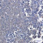 TXNDC9 Recombinant Rabbit Monoclonal Antibody (K01_2J69)