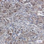TrxR1 Antibody in Immunohistochemistry (Paraffin) (IHC (P))