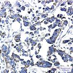 TrxR2 Recombinant Rabbit Monoclonal Antibody (K01_2J72)