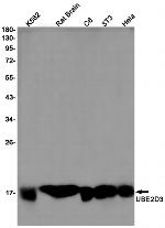 UBE2D3 Recombinant Rabbit Monoclonal Antibody (K01_2J76)