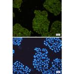 UFC1 Recombinant Rabbit Monoclonal Antibody (K01_2J82)