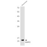 VAMP2 Antibody in Western Blot (WB)