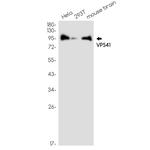 VPS41 Antibody in Western Blot (WB)