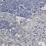 VPS4A Antibody in Immunohistochemistry (Paraffin) (IHC (P))