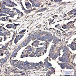 WDR1 Antibody in Immunohistochemistry (Paraffin) (IHC (P))