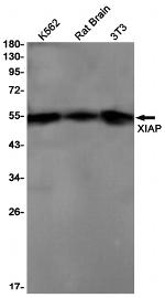 XIAP Recombinant Rabbit Monoclonal Antibody (K01_2K17)