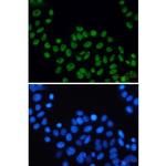XPD Recombinant Rabbit Monoclonal Antibody (K01_2K19)