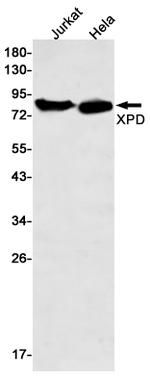 XPD Antibody in Western Blot (WB)