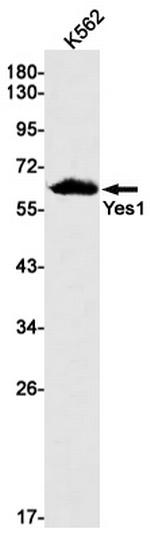 YES1 Recombinant Rabbit Monoclonal Antibody (K01_2K25)