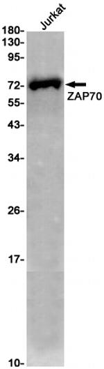 Zap-70 Recombinant Rabbit Monoclonal Antibody (K01_2K28)