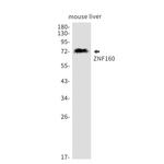 ZNF160 Recombinant Rabbit Monoclonal Antibody (K01_2K29)