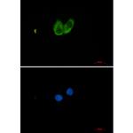 Zyxin Recombinant Rabbit Monoclonal Antibody (K01_2K31)