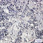 Zyxin Antibody in Immunohistochemistry (Paraffin) (IHC (P))