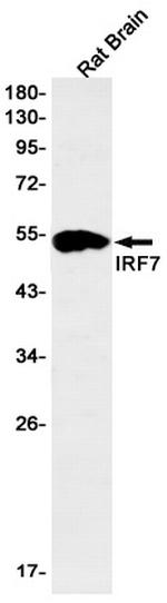 IRF7 Antibody in Western Blot (WB)