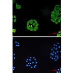 SURF4 Antibody in Immunocytochemistry (ICC/IF)