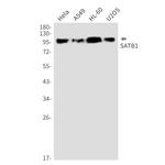 SATB1 Antibody in Western Blot (WB)
