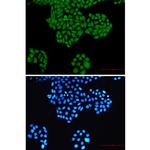 RYK Recombinant Rabbit Monoclonal Antibody (K01_2K41)