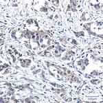 RYK Antibody in Immunohistochemistry (Paraffin) (IHC (P))