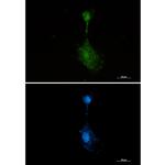 RSK3 Recombinant Rabbit Monoclonal Antibody (K01_2K42)