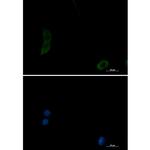 PAK1 Recombinant Rabbit Monoclonal Antibody (K01_2K43)