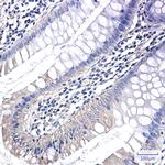 PAK1 Antibody in Immunohistochemistry (Paraffin) (IHC (P))