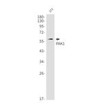 PAK1 Antibody in Western Blot (WB)