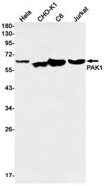 PAK1 Antibody in Western Blot (WB)