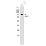 MSP Antibody in Western Blot (WB)
