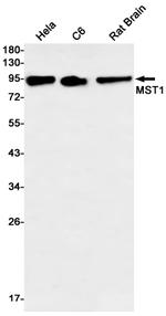 MSP Antibody in Western Blot (WB)