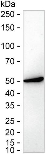ETS1 Recombinant Rabbit Monoclonal Antibody (K01_2K47)