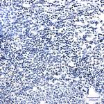 PIM1 Recombinant Rabbit Monoclonal Antibody (K01_2K50)