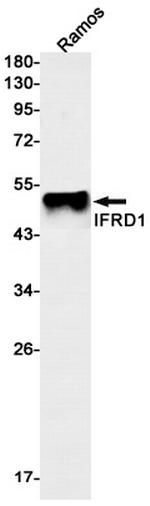IFRD1 Recombinant Rabbit Monoclonal Antibody (K01_2K52)