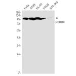 NEDD4 Recombinant Rabbit Monoclonal Antibody (K01_2K53)