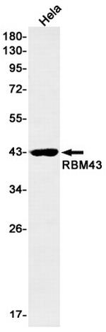 RBM43 Recombinant Rabbit Monoclonal Antibody (K01_2K57)