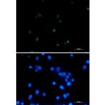 POLR2A Recombinant Rabbit Monoclonal Antibody (K01_2K64)