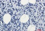 POLR2A Antibody in Immunohistochemistry (Paraffin) (IHC (P))