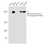 POLR2A Antibody in Western Blot (WB)