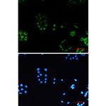 PACSIN3 Recombinant Rabbit Monoclonal Antibody (K01_2K65)