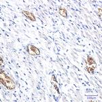 PACSIN3 Antibody in Immunohistochemistry (Paraffin) (IHC (P))