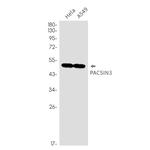 PACSIN3 Antibody in Western Blot (WB)